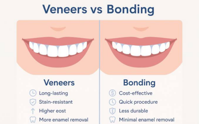 Dental Bonding vs. Veneers: What Are the Key Differences?