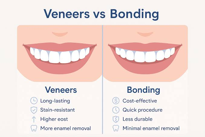 Dental Bonding vs. Veneers: What Are the Key Differences?