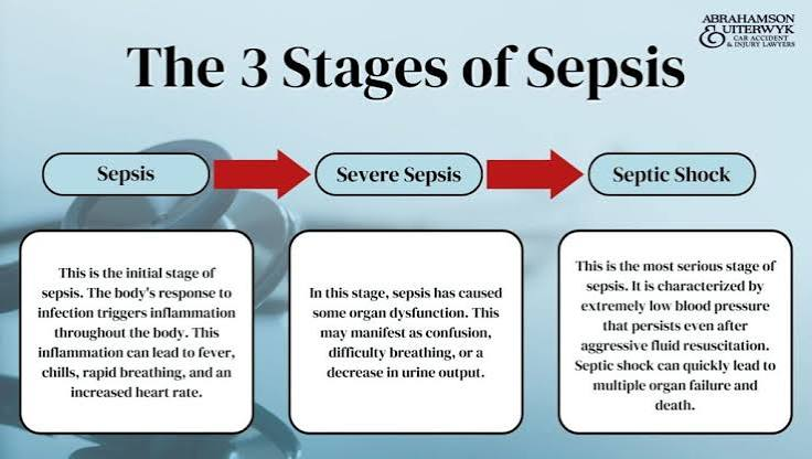 New Diagnostic Blood Test Marks Major Progress in the Global Battle Against Sepsis