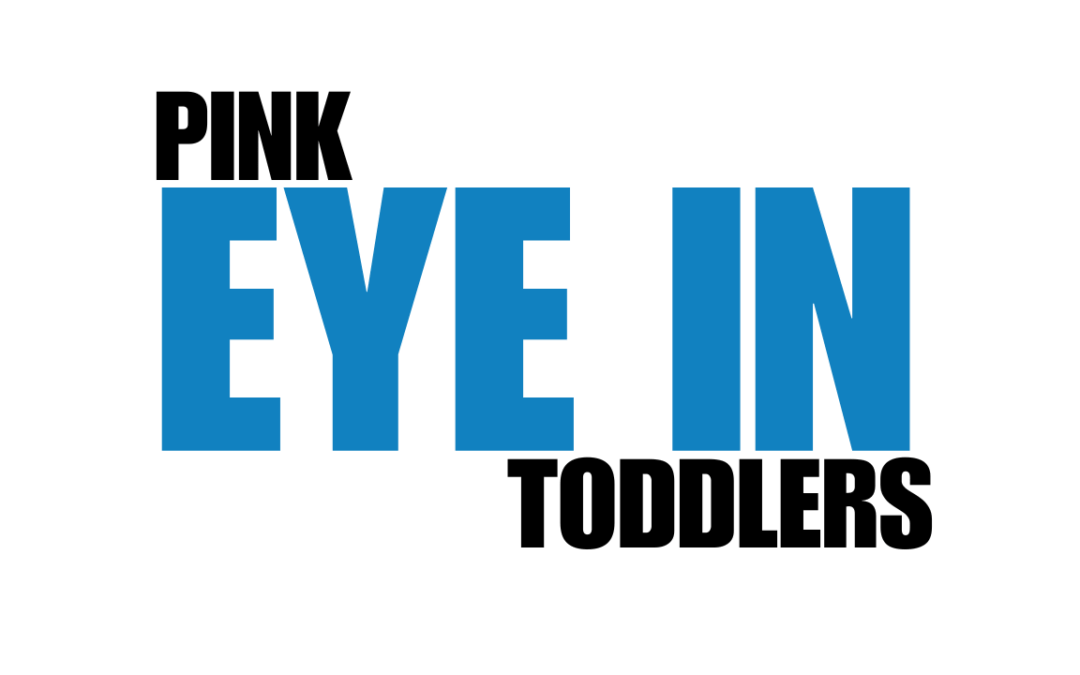 Pink Eye in Toddlers: Everything You Need to Know